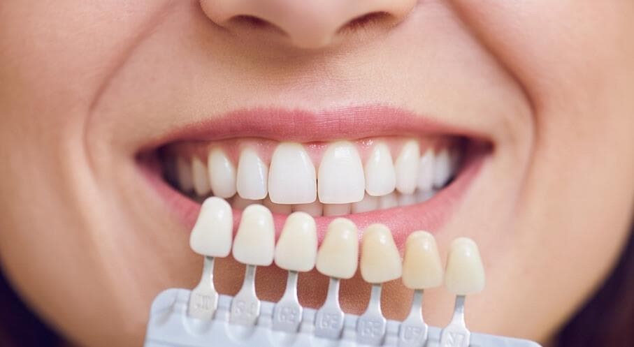 Coronas sobre dientes tratados con endodoncia: claves del diseño
