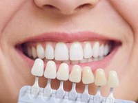 Coronas sobre dientes tratados con endodoncia: claves del diseño