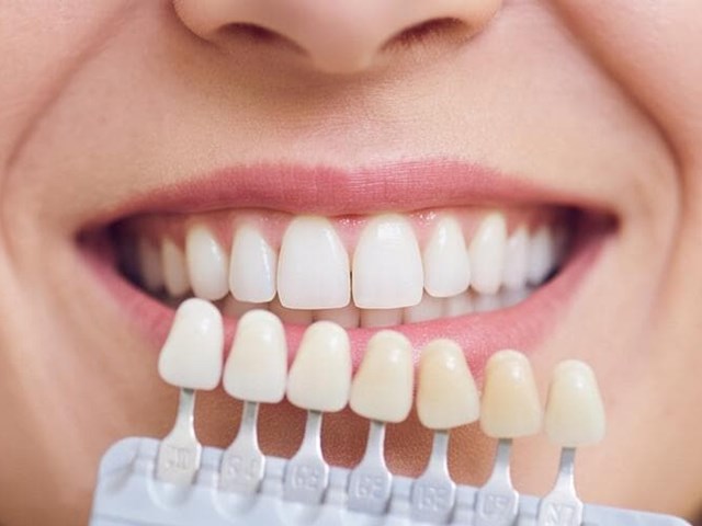 Coronas sobre dientes tratados con endodoncia: claves del diseño