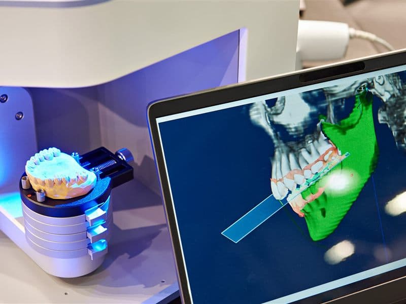 Sistema CAD-CAM en Narón