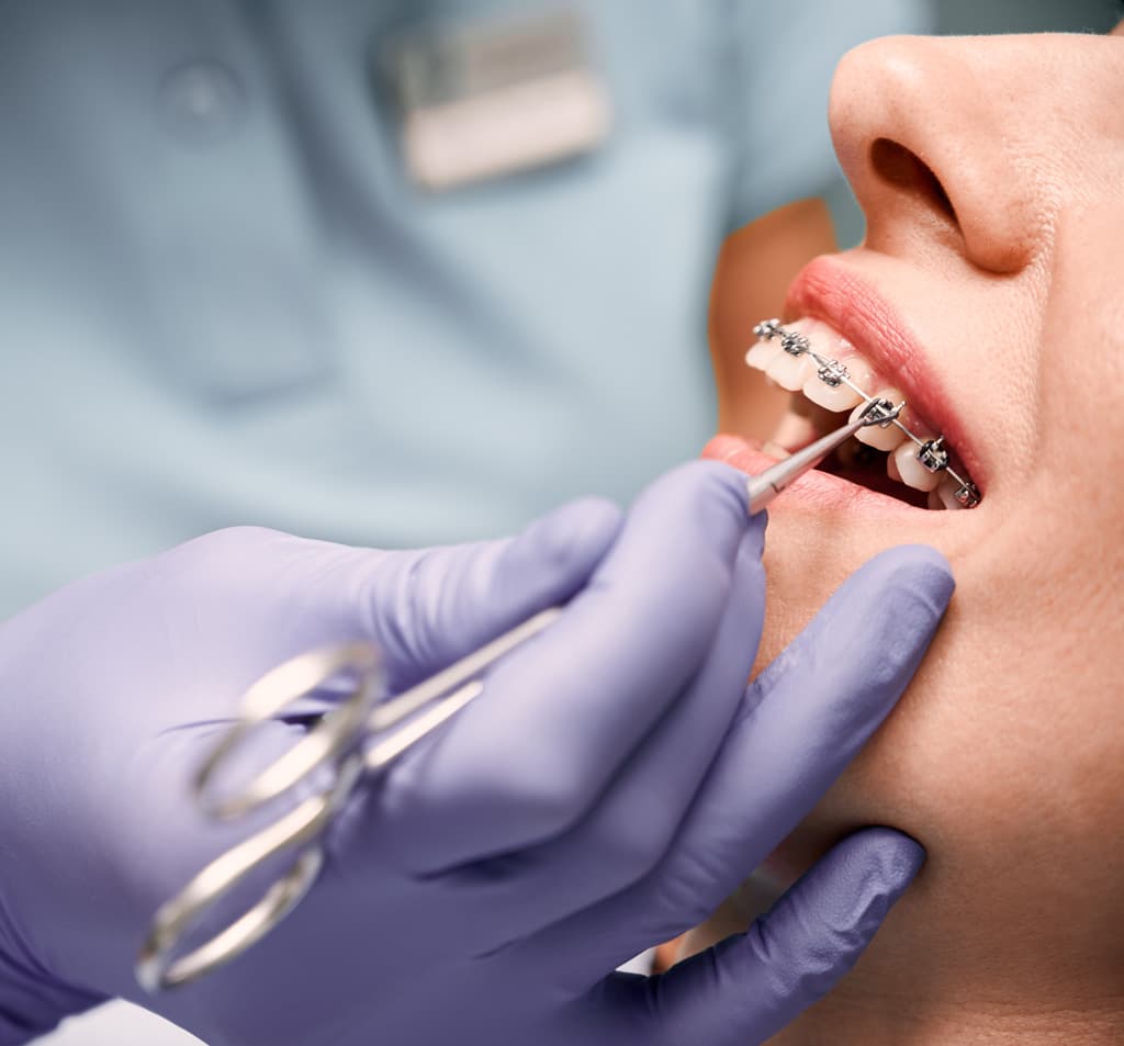 Tratamientos de ortodoncia en Narón