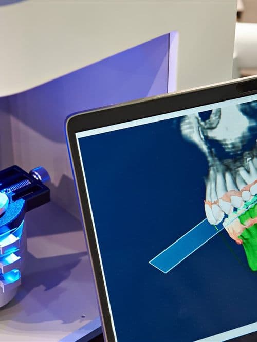 Laboratorio dental CAD-CAM en Narón - Trasancos