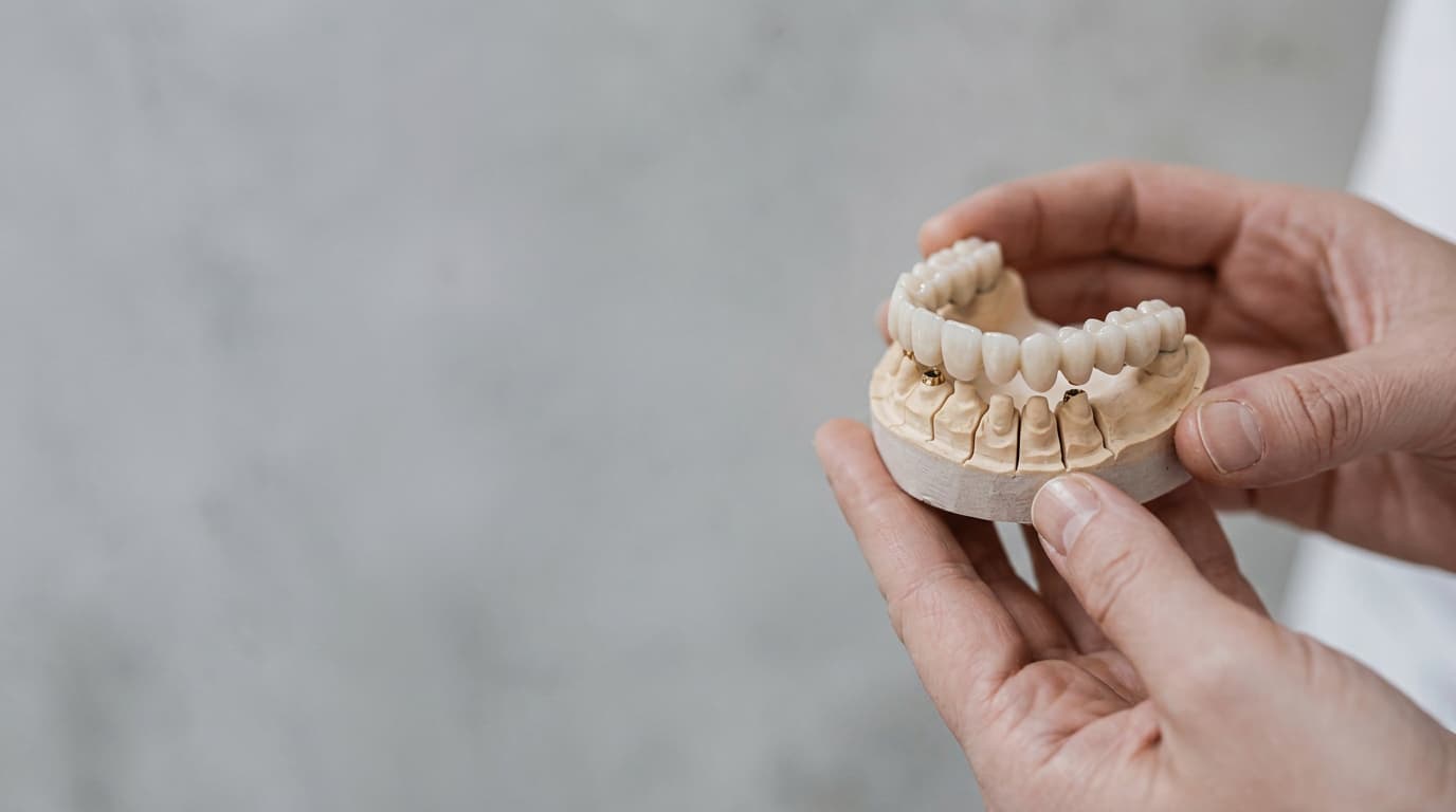 Laboratorio dental experto en prótesis fijas de odontología en Narón