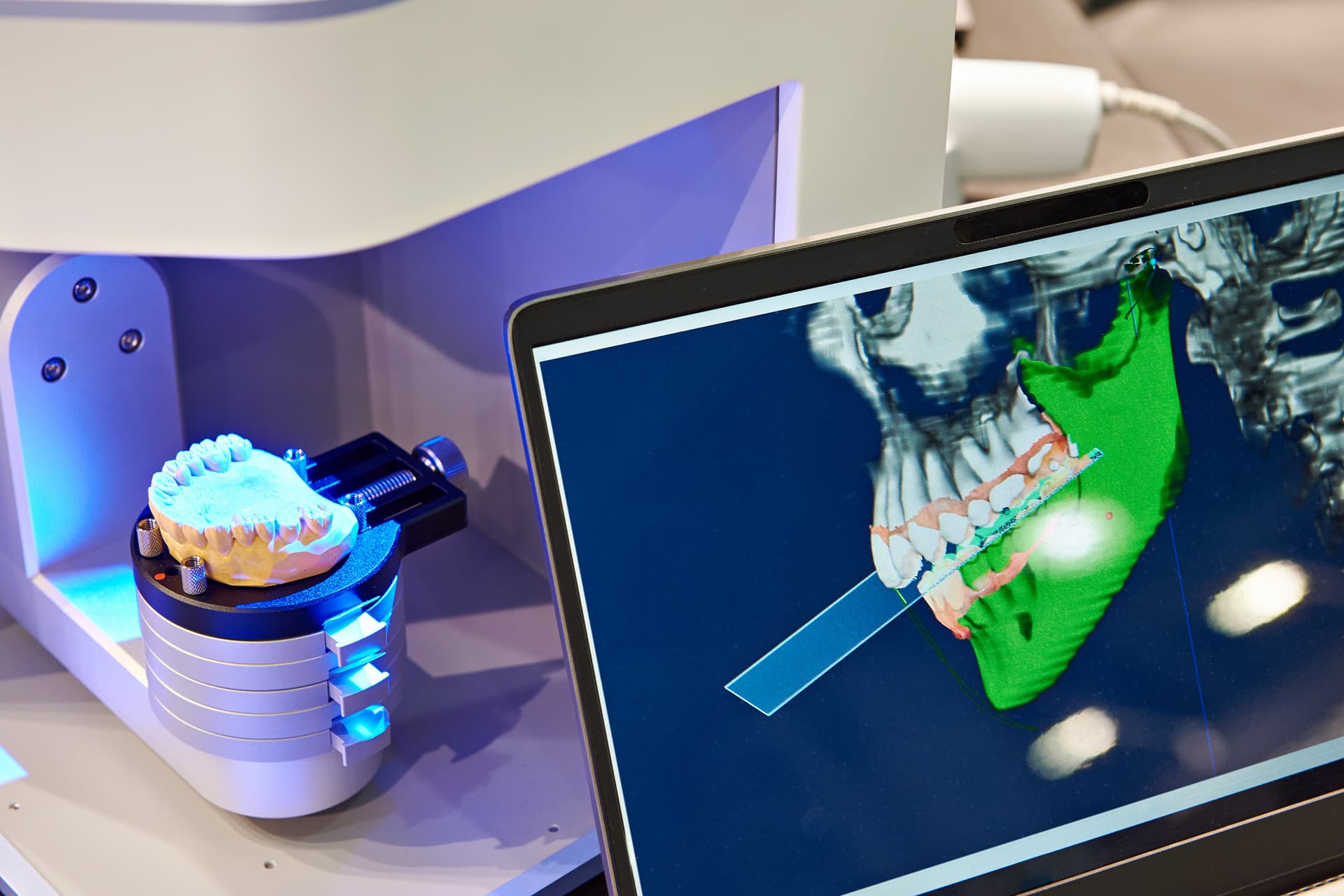 Laboratorio dental CAD-CAM en Narón