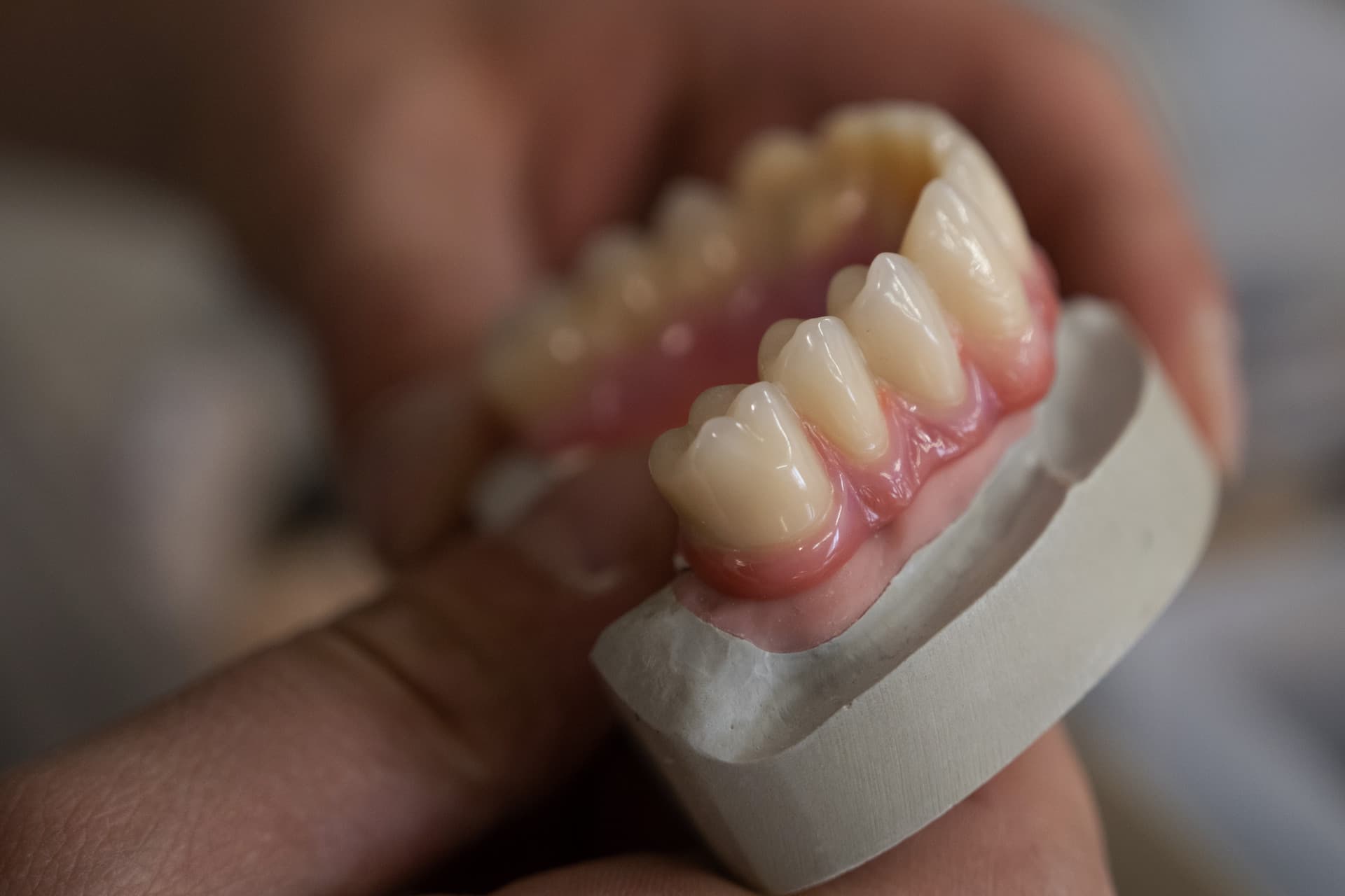 Prótesis dentales fijas en Narón