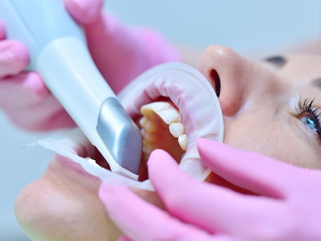La tecnología avanzada que revoluciona la odontología moderna: escáner intraoral