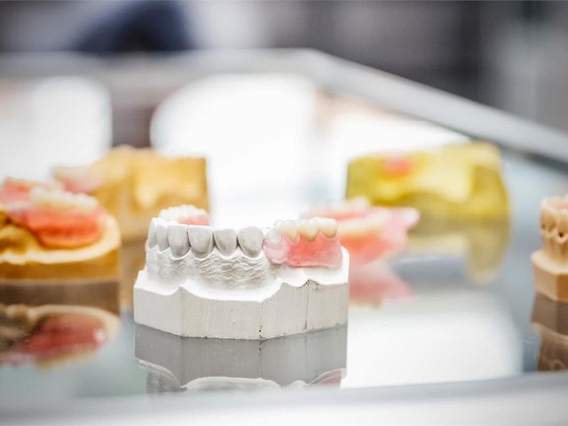 Materiales biocompatibles para prótesis dentales: lo último en innovación y resistencia