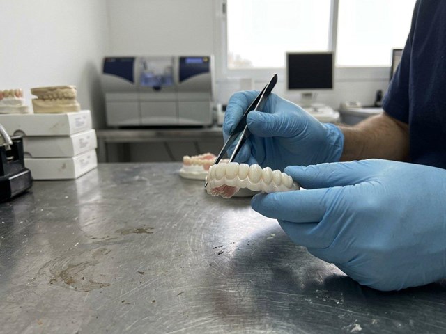 Menos invasión, más precisión: prótesis móviles de circonio con CAD-CAM en Fene