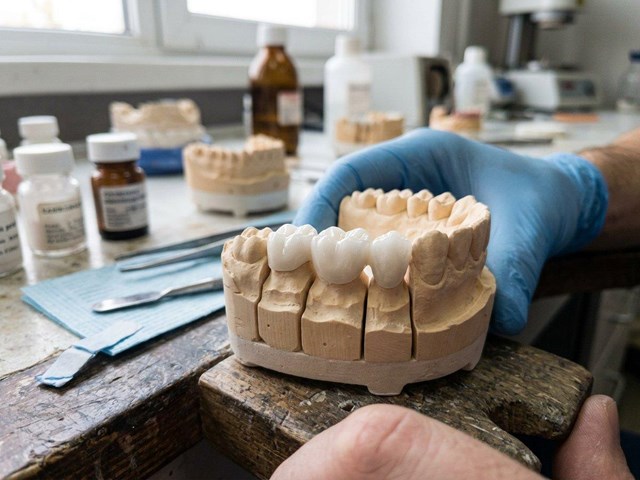 Rehabilitaciones estéticas con prótesis fijas de circonio en Fene