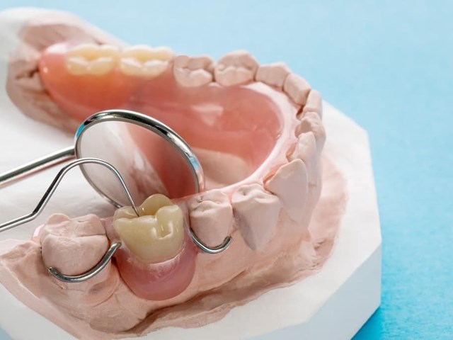 Rentabilidad en la odontología protésica: Maximizando los resultados con el apoyo de tu laboratorio dental