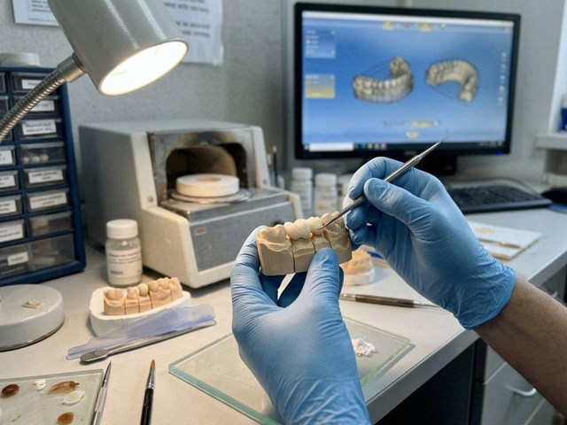 Resultado natural y duradero: prótesis fijas de circonio en Cedeira