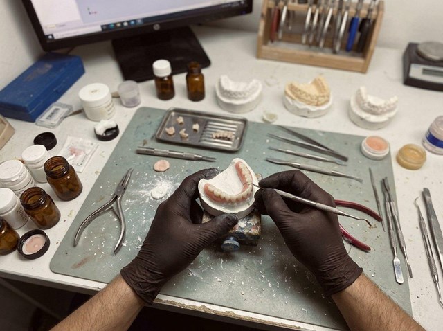 Solución rápida tras la pérdida dental: prótesis móviles de circonio en Cedeira - Imagen 1