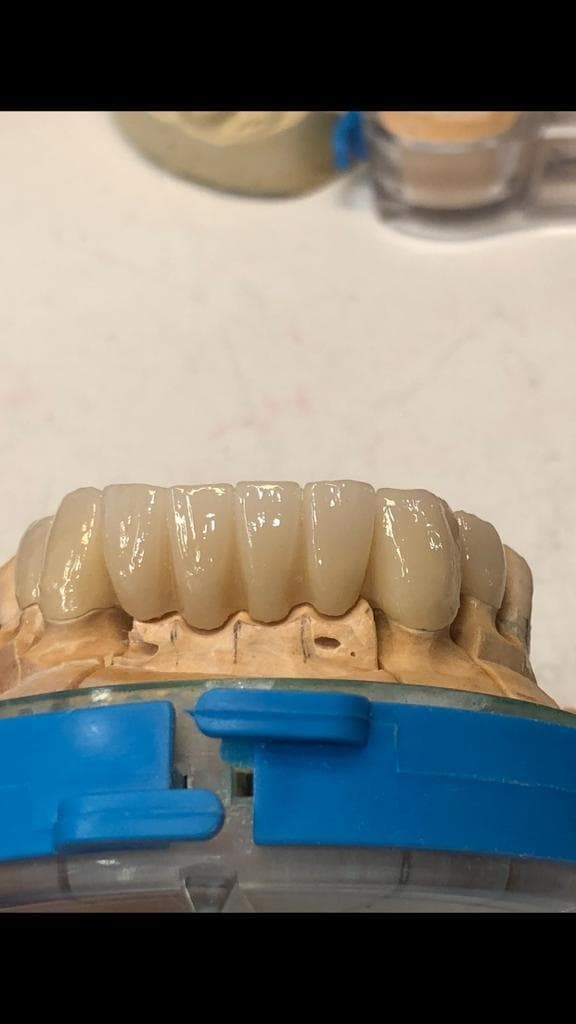 Trabajo en zirconio