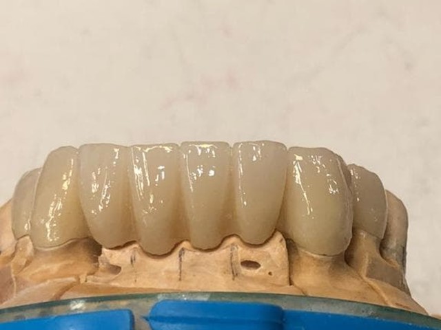 Trabajo en zirconio