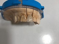 Trabajo en zirconio