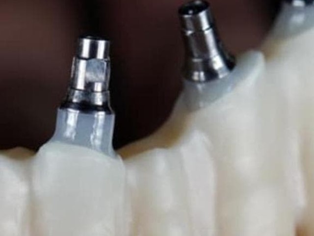 Trabajos realizados sobre implantes